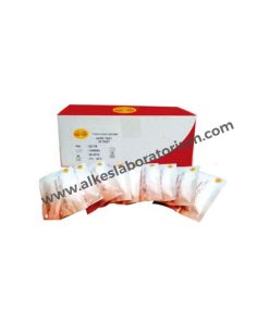 Jual Alat Kesehatan Laboratorium Hepatitis C Rapid Test Glory