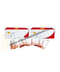 Jual Alat Kesehatan Laboratorium Syphilis Rapid Test Glory