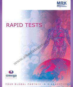 Jual Alat Kesehatan Laboratorium Serology Rapid Test Omega