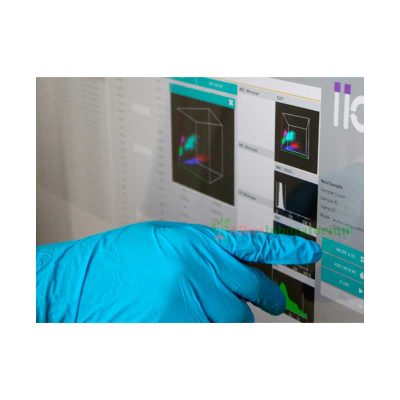 ELITE 580 ERBA Hematology Analyzer - Alkeslaboratorium