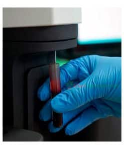 ELITE 580 ERBA Hematology Analyzer - Alkeslaboratorium