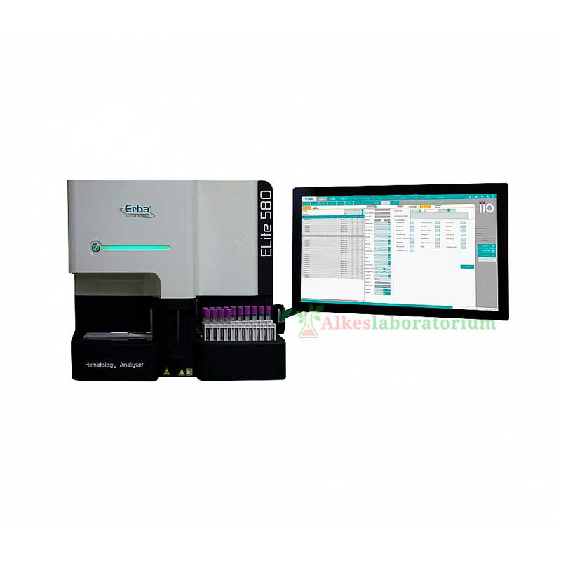ELITE 580 ERBA Hematology Analyzer - Alkeslaboratorium