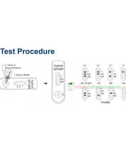 Rapid-Test-Typhoid-IgG-IgM-Accurate--Alkeslaboratorium-(3)