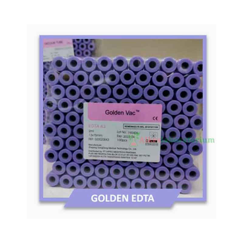 Vacutainer-EDTA-Merk-Golden---Alkeslaboratorium