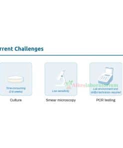 Pluslife-MTBC-Rapid-Test---Alkeslaboratorium-(9)